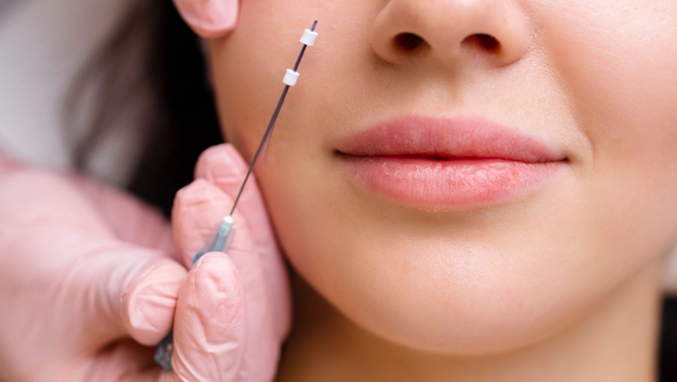 Tratamiento facial hilos tensores